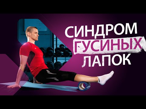 Видео: Как корректировать гусиные лапки, причины и решение проблемы