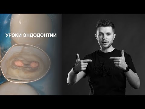 Видео: Уроки эндодонтии. Пилотная серия: обтурация сходящихся каналов