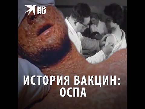 Видео: История вакцин: оспа
