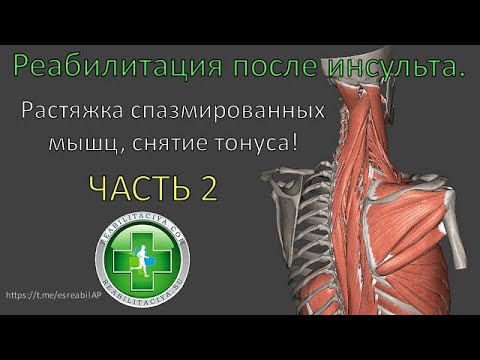 Видео: Растяжка спазмированныз мышц после инсульта. Снижение спастики, разработка контрактур.