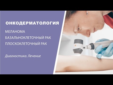 Видео: Онкодерматология в Клинике высоких медицинских технологий им. Н. И. Пирогова