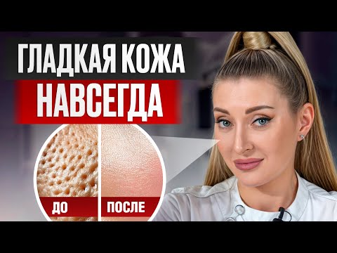 Видео: Как НАВСЕГДА сузить поры? / ЛУЧШИЕ средства для идеальной кожи