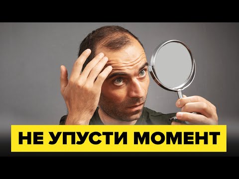 Видео: Когда уже поздно пересаживать волосы? |  Долгов Александр Николаевич