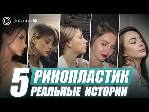 Видео: Реабилитация ринопластика! Вся правда про процесс восстановления