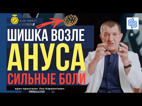 Видео: НАРУЖНЫЕ ГЕМОРРОИДАЛЬНЫЕ УЗЛЫ лев багдасарян