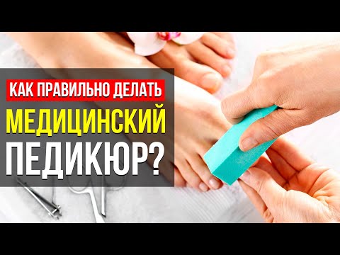 Видео: МЕДИЦИНСКИЙ ПЕДИКЮР! ВСЯ ВАЖНАЯ ИНФОРМАЦИЯ: КАК ОН ПРАВИЛЬНО ДЕЛАЕТСЯ И ЧЕМ ОТЛИЧАЕТСЯ ОТ ОБЫЧНОГО