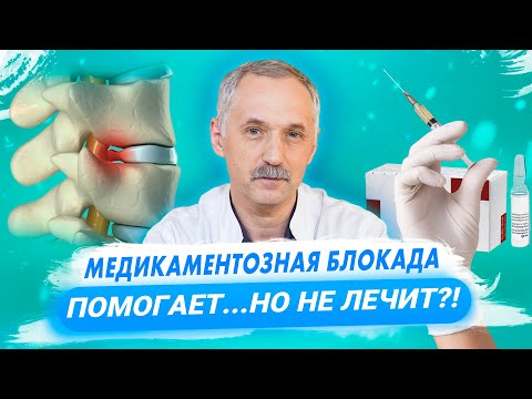 Видео: Медикаментозная блокада: все, что вам нужно знать / Доктор Виктор