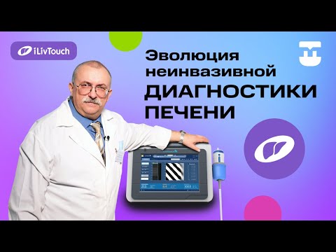 Видео: Диагностика печени: от биопсии до эластометрии.