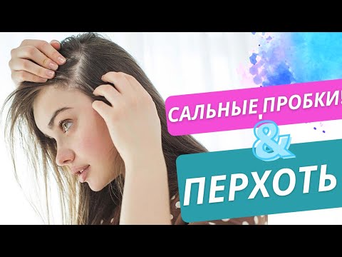 Видео: Выпадение волос..сальные пробки…(как они связанны)