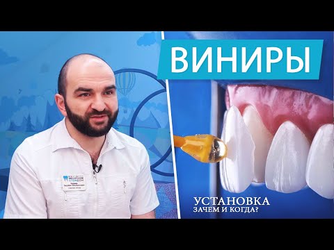Видео: Виниры - плюсы и минусы. Зачем и когда устанавливать | часть 1