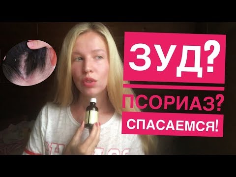 Видео: РУСЫ КОСЫ: НЕРВНЫЙ ПСОРИАЗ И КАК ЕГО ОДОЛЕТЬ