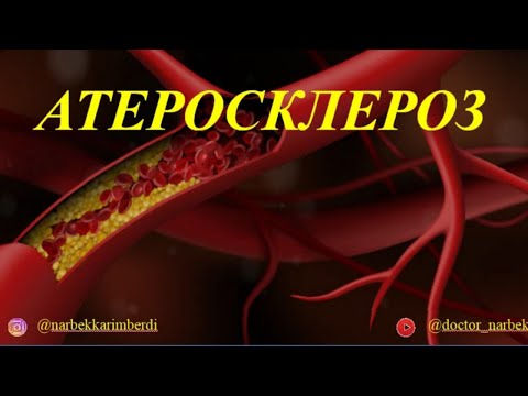 Видео: АТЕРОСКЛЕРОЗ | этиология, патогенез, симптомы, алдын алу шаралары