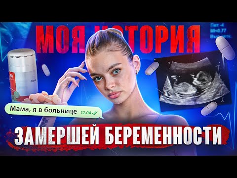 Видео: МОЯ ИСТОРИЯ ЗАМЕРШЕЙ БЕРЕМЕННОСТИ. Аня Ищук