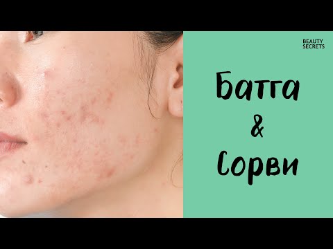 Видео: Арьс арчилгааны анхан шатны хичээл #3: Батгашилт ба сорвины тухай