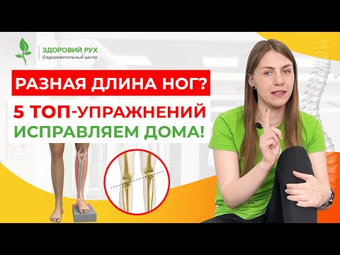 Видео: ИСПРАВЛЯЕМ РАЗНУЮ ДЛИНУ НОГ. Простые упражнения. Кинезитерапия