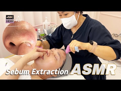 Видео: ASMR | Идеальное извлечение кожного сала, выдавливание прыщей с помощью техники шелкового бритья