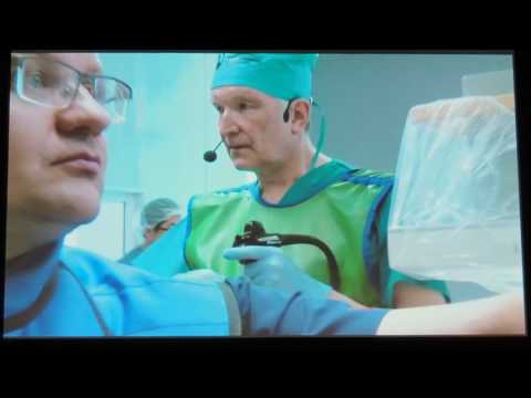 Видео: 08Live Киста головки поджелудочной железы T Rosch EUS дренирование кисты