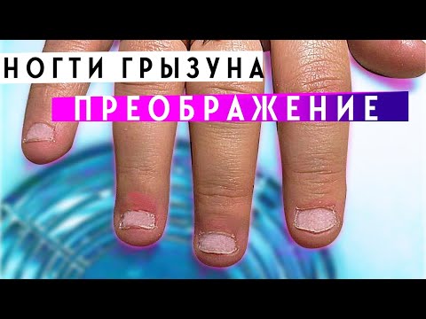 Видео: ПРЕОБРАЖЕНИЕ НОГТЕЙ ГРЫЗУНА ЗА 1 ЧАС! ПОЖАЛУЙ, САМАЯ БЫСТРАЯ РАБОТА НАРАЩИВАНИЯ САМЫХ СЛОЖНЫХ НОГТЕЙ