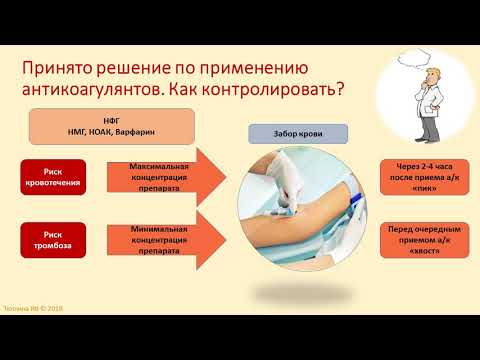 Видео: Тромбодинамика - принцип теста, параметры и их интерпретация.