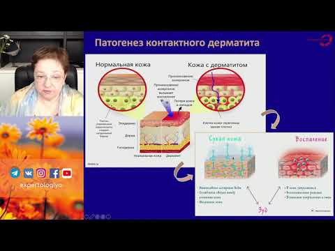 Видео: Экспертология | Зуд вульвы