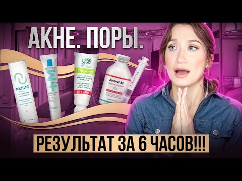 Видео: Проблемная, жирная кожа и акне 🔔 НОВАЯ ПОДБОРКА