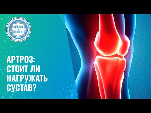 Видео: 👨‍⚕️ Артроз: стоит ли нагружать сустав?