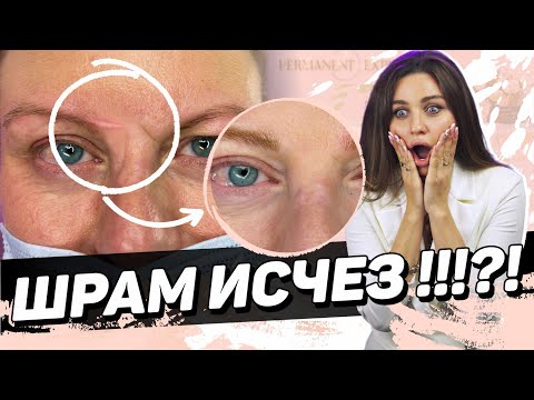 Видео: Как сделать татуаж шрама?