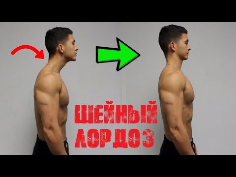 Видео: КАК ИСПРАВИТЬ ШЕЙНЫЙ ЛОРДОЗ - лучшие упражнения | Джереми Этье