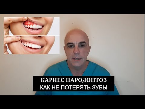 Видео: Кариес, ПАРОДОНТОЗ как не потерять зубы Мой опыт