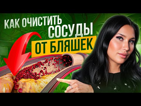 Видео: КАРДИОЛОГ о бляшках в сосудах – ТО, о чем НЕ принято говорить!
