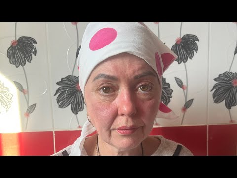 Видео: ОНКОЛОГИЯ (СБОР ОТКРЫТ)