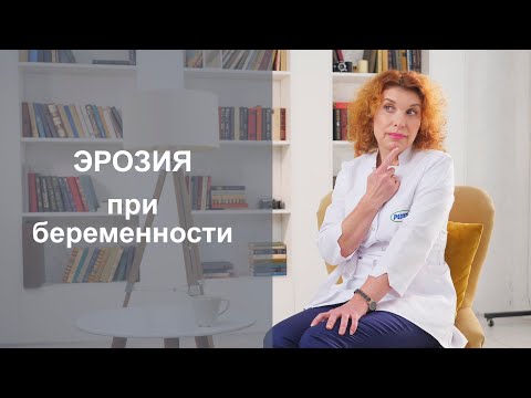 Видео: ЭРОЗИЯ ШЕЙКИ МАТКИ ПРИ БЕРЕМЕННОСТИ. Можно ли лечить?