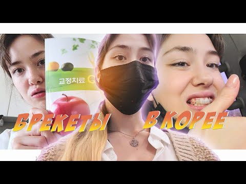 Видео: VLOG| СТАВЛЮ БРЕКЕТЫ В КОРЕЕ
