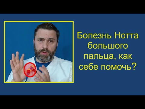 Видео: Болезнь Нотта (щелкающий палец) большого пальца. Как себе помочь?