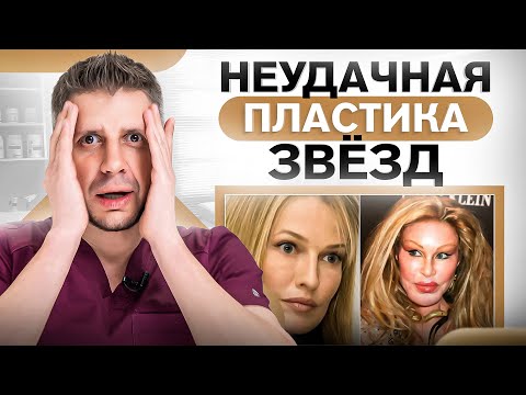 Видео: 5 звезд, которые постарели после пластики! Что они с собой сделали? (мнение пластического хирурга)