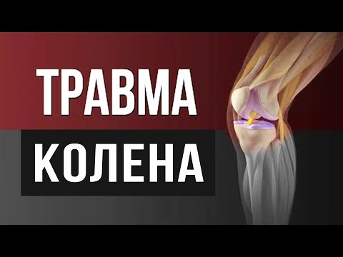 Видео: Травмы колена: причины, диагностика, лечение, реабилитация - Мениски, связки