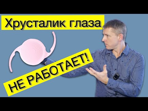 Видео: Лечение катаракты и замена хрусталика глаза: когда хрусталик "не работает"