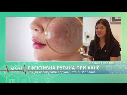 Видео: Стъпка по стъпка: Излекувай кожата от акне!