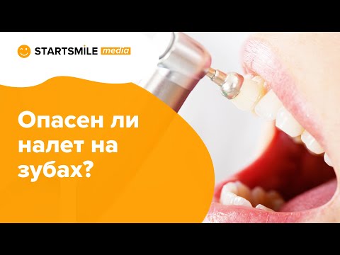 Видео: Налет на зубах | Причины и способы лечения