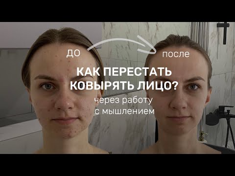 Видео: ВРЕДНАЯ ПРИВЫЧКА ковырять лицо| МОЙ ОПЫТ и результат за 1 год | через самоанализ и коучинг