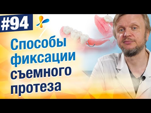 Видео: Какие бывают способы фиксации съемных протезов?