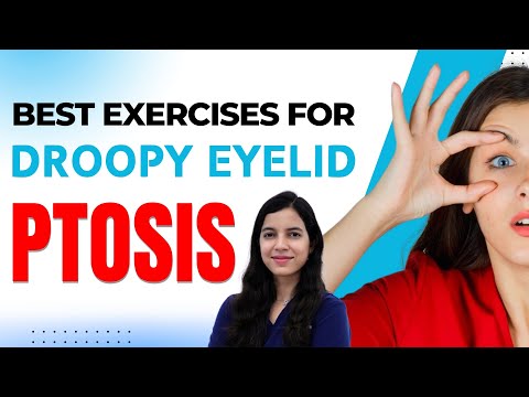 Видео: Лучшие упражнения при опущении века от пластического хирурга | Доктор Анамика Джоши