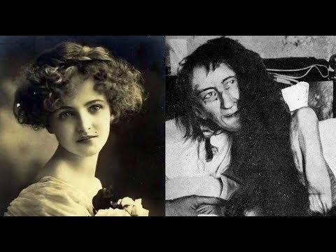 Видео: Бланш Монье. Трагедия красавицы из Пуатье.