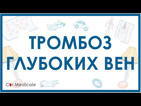 Видео: Тромбоз глубоких вен: что такое, симптомы, осложнения, принцип лечения