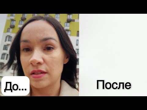 Видео: Моё преображение. ДО и ПОСЛЕ