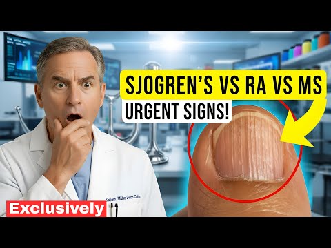 Видео: Болезнь Шегрена, ревматоидный артрит или рассеянный склероз — полное руководство по симптомам — к...