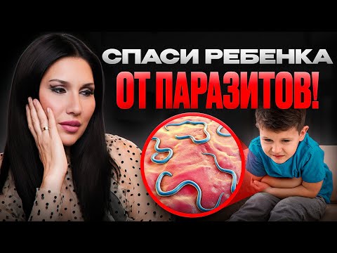 Видео: ПАРАЗИТЫ У ДЕТЕЙ: Как вовремя спасти ребенка