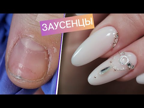 Видео: Свадебные ЗАУСЕНЦЫ 😱 Свадебный маникюр с треснувшей кутикулой. 💎 Наращивание ногтей со стразами