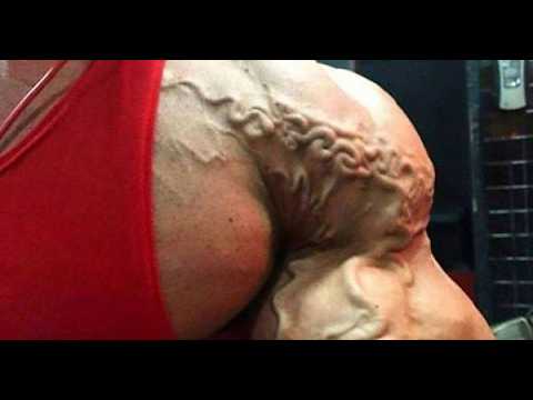 Видео: ЖУТКИЕ ВЕНЫ / САМЫЕ ЖЁСТКИЕ СЛУЧАИ