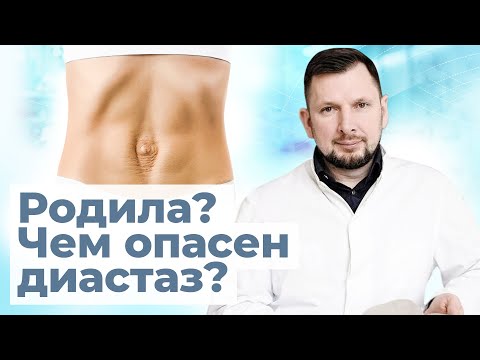 Видео: Послеродовый диастаз опаснее чем вы думаете | Диастаз и его степени